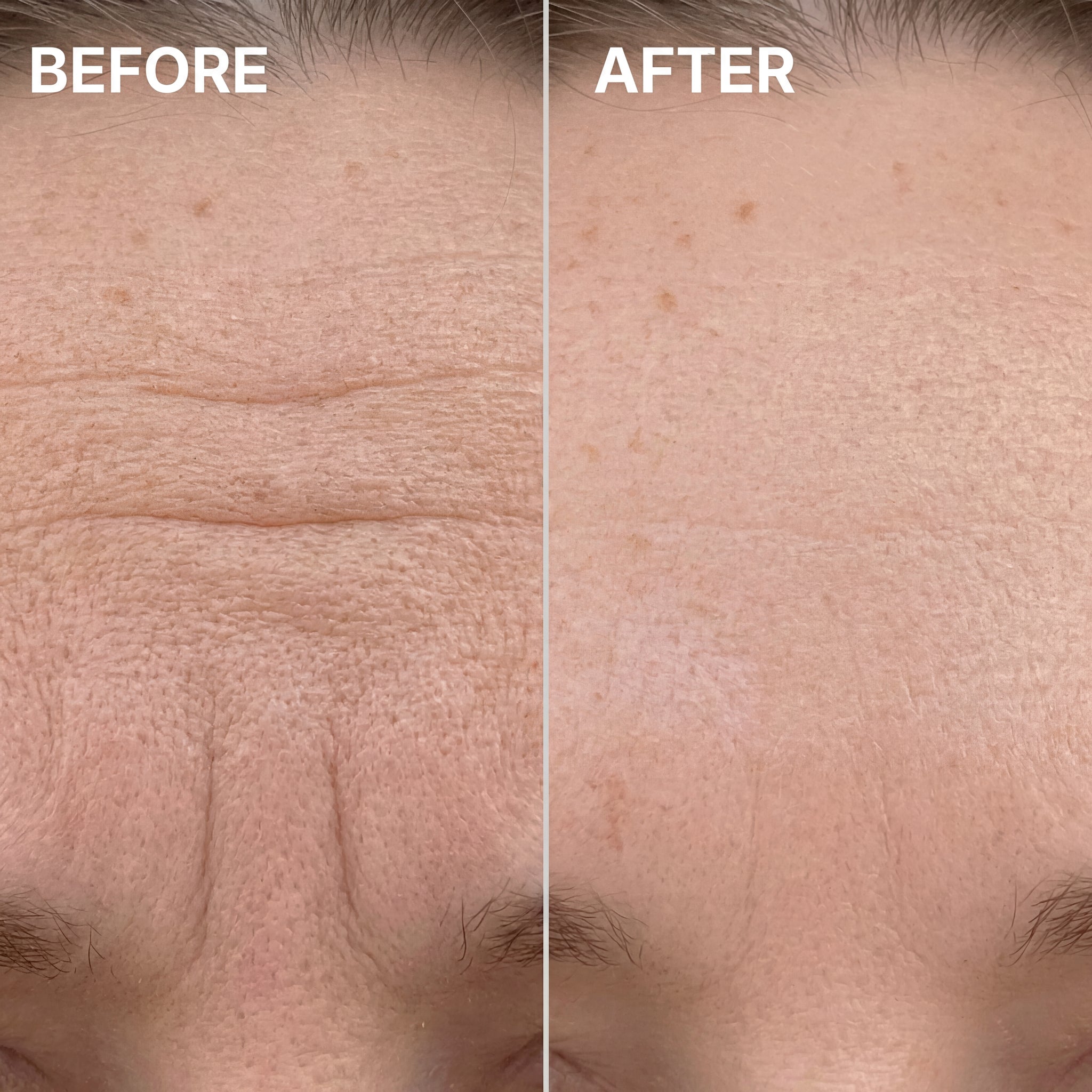 PDRN Pink Collagen Volume Multi Balm